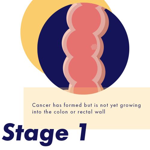 Colorectal Cancer Awareness Month - Spread Awareness Today ...